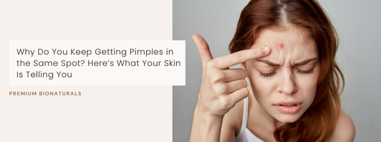 Map causes when you keep getting pimple in same spot