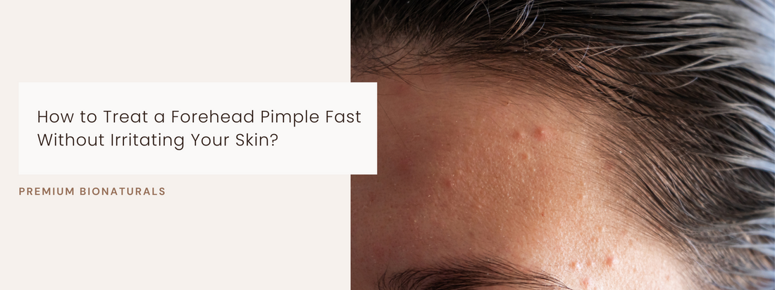 Natural ways to heal a forehead pimple and prevent future breakouts from ruining your skin.