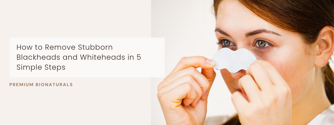 Remove blackheads & whiteheads effortlessly for clear, smooth skin